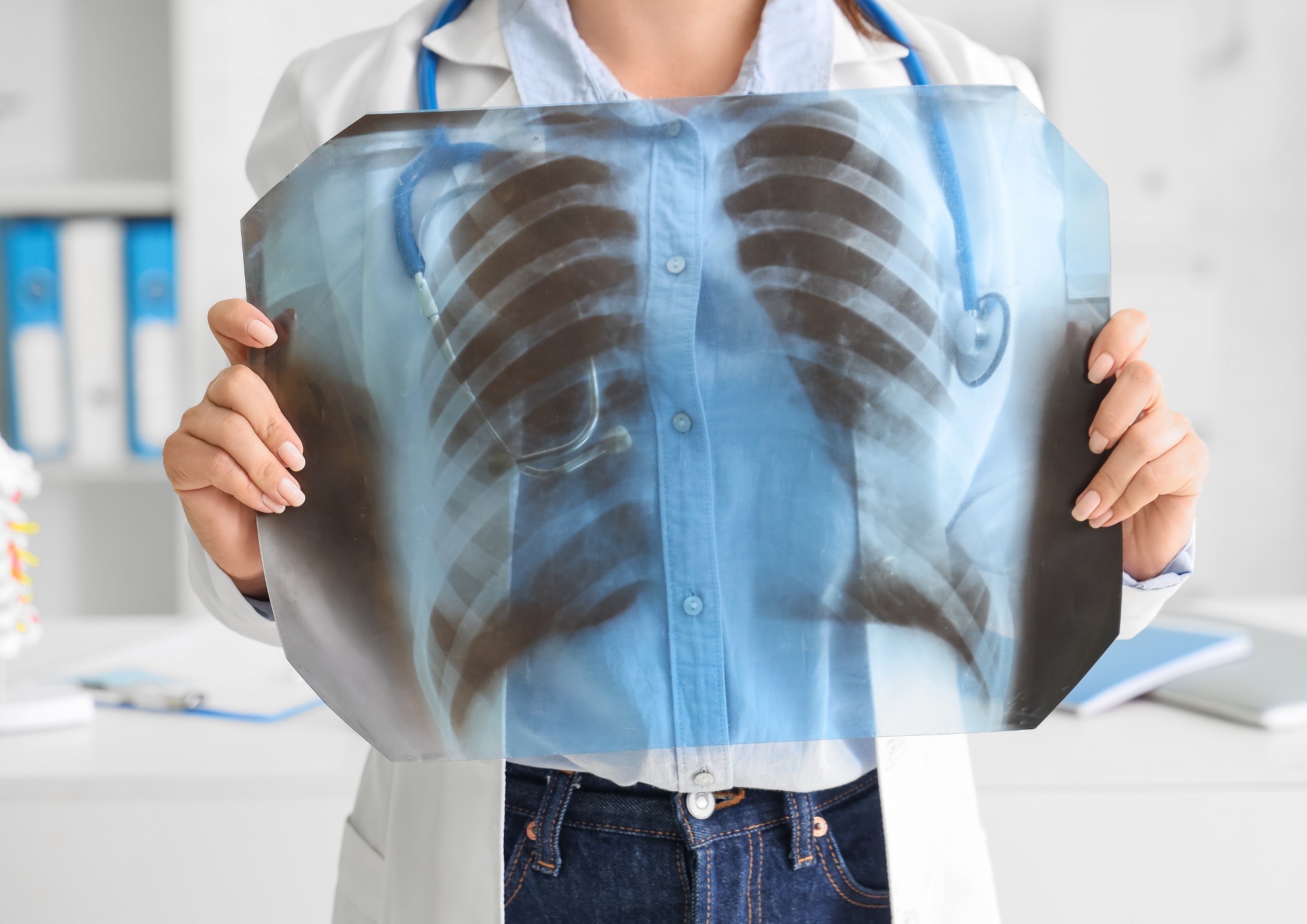 がんの早期発見に繋がる最新の画像診断技術のアイキャッチ画像｜がん共済アイリス